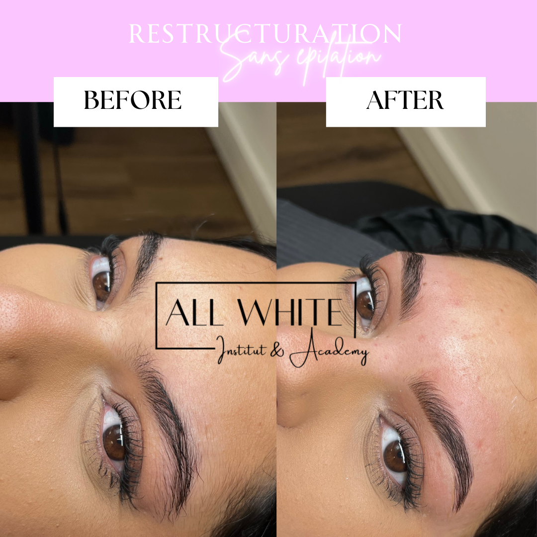 Restructuration sans épilation avec teinture offerte